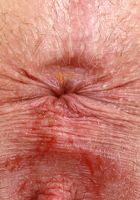 Alex Kane Hot Spreads, Alex Kane (ale174) ATK Petites: Alex Kane (Alex Kane Hot Spreads)