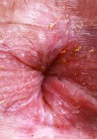 ATK Exotics: Aubry Babcock (Aubry Babcock Yoga Spreading)