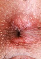 Reina Heart Spreads Her Tight Holes, Reina Heart (rei001) ATK Exotics: Reina Heart (Reina Heart Spreads Her Tight Holes)