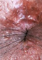 ATK Exotics: Rhae Woods (Rhae Woods is taking it all off)