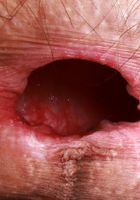 ATK Natural & Hairy: Sia Wood (Sia Wood in leather and boots)