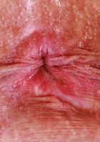 ATK Galleria: Sonny Mckinley (Sonny McKinley Ass Up Spreading)